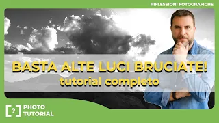 📸  Gamma dinamica : Addio alle ALTE LUCI BRUCIATE –  tutorial completo!